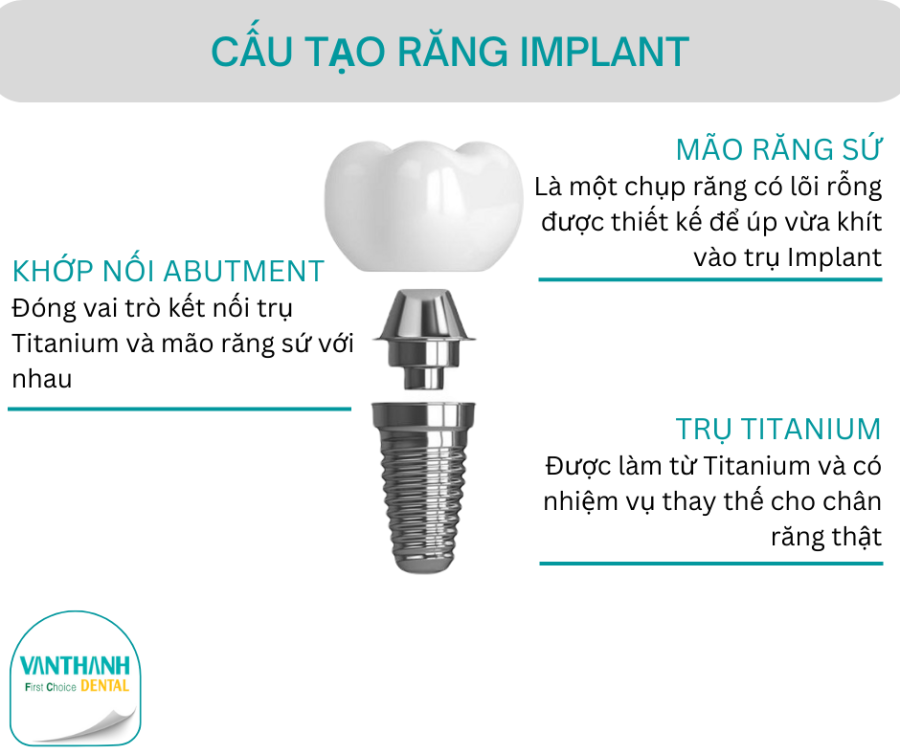 trồng răng implant gây dị ứng 